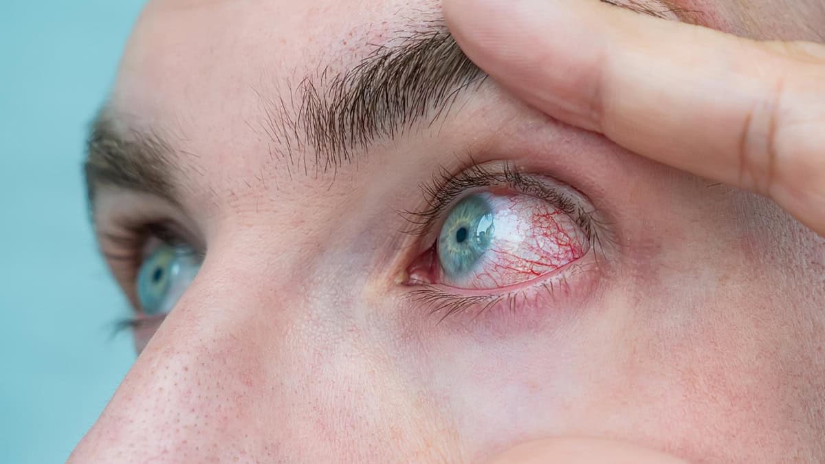 Doctor inspecting patient's red eye