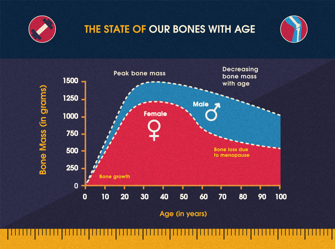 The State of Our Bones With Age