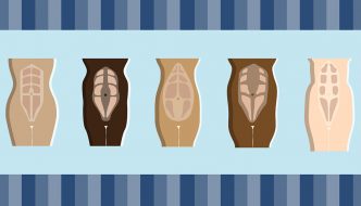 What is Diastasis? And What You Can Do About it