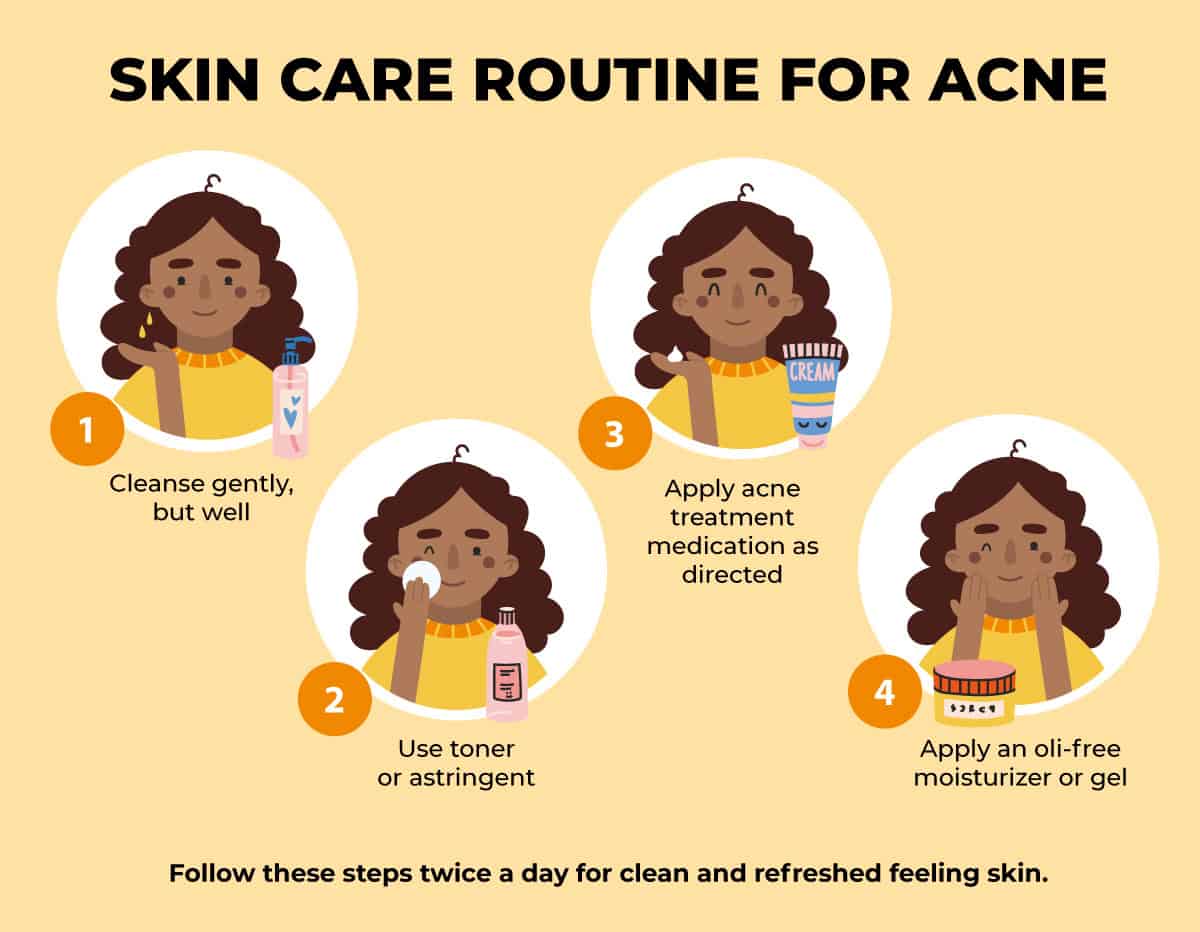 Acne skin care routine infographic
