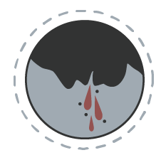Vomiting brown or red blood