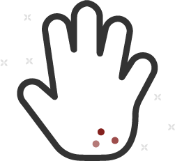 Itching or skin rash