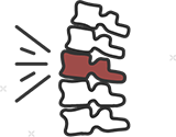 Back pain