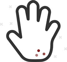 Rash