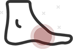 Swelling in the hands, feet, or breasts