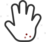 Skin irritation