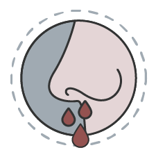 Frequent or long nose bleeds