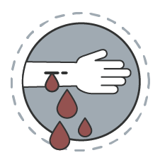 New pain, draining, or swelling from wounds