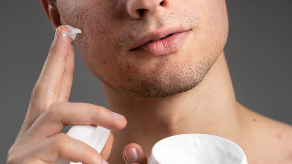 Arazlo vs Tretinoin: Which is Right for You?