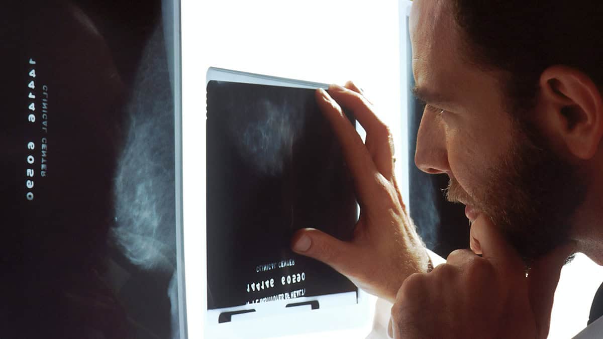 Complete Guide to Orgovyx for Advanced Prostate Cancer
