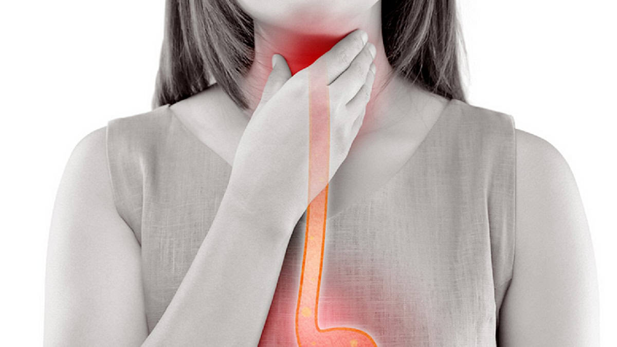 Women having acid reflux