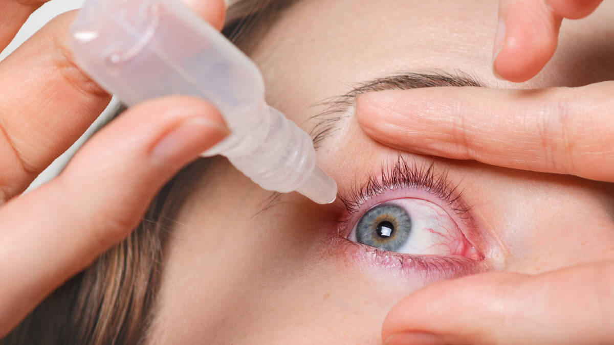 Person putting eye drops in her eyes