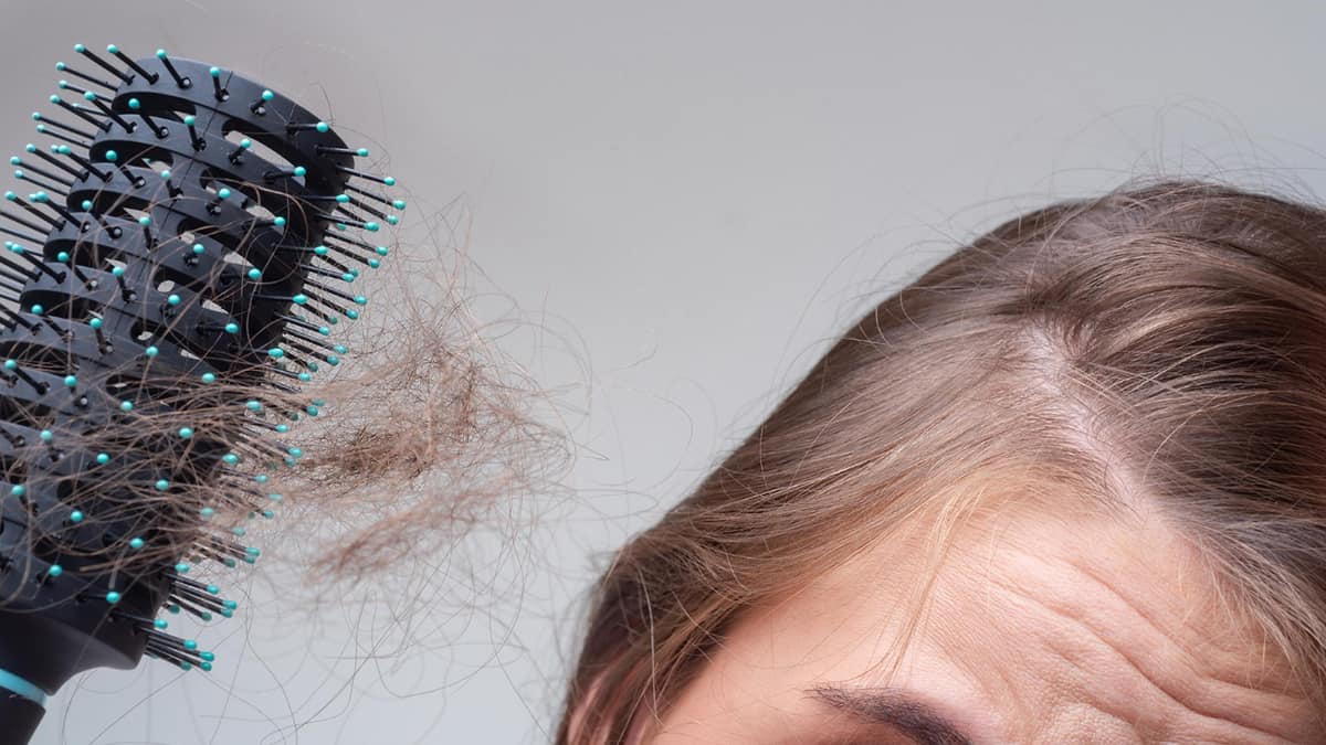 Treating Female Hair Loss