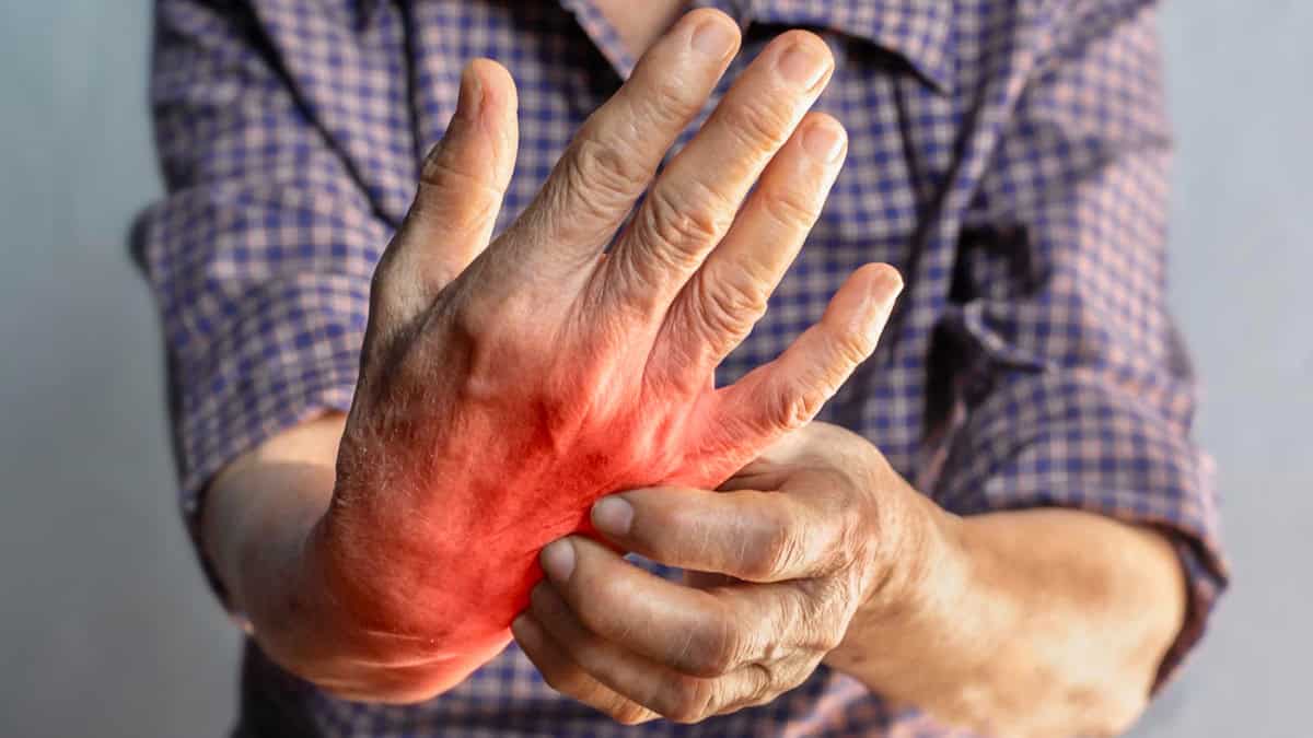 Your Complete Guide to Xeljanz for Rheumatoid Arthritis