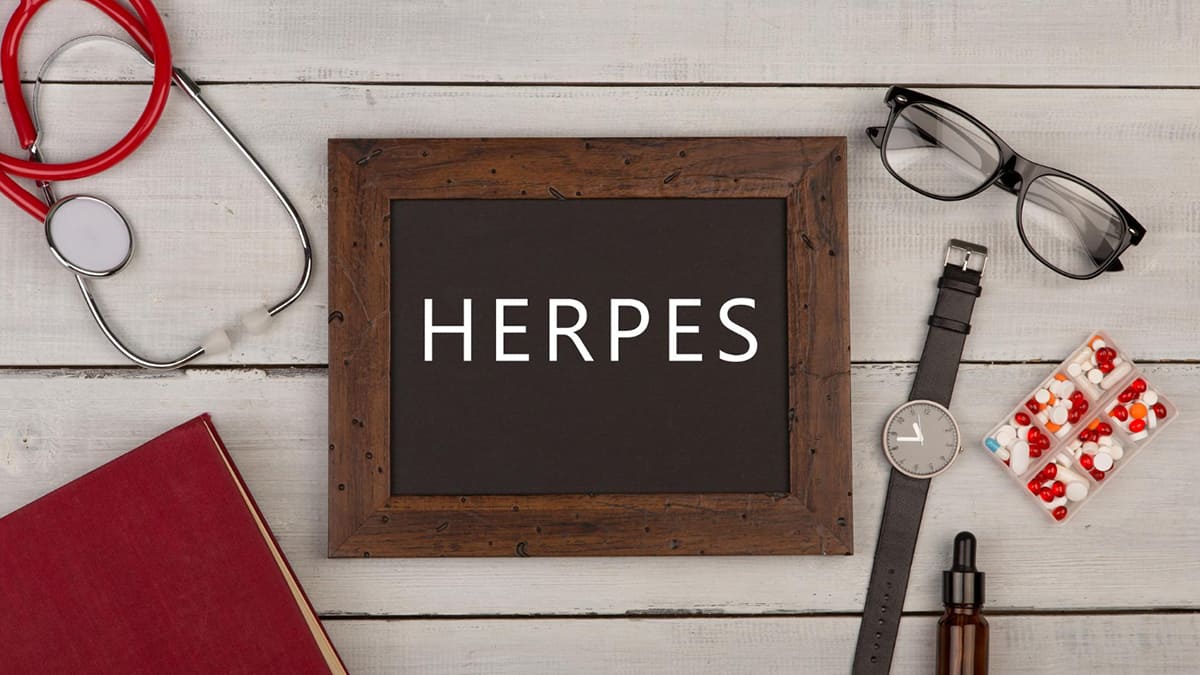 Herpes Medication