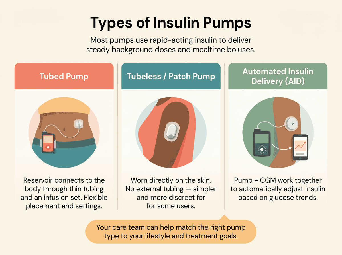 Types of insulin pumps infographic