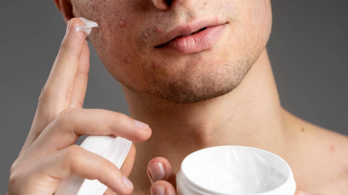 Popular Acne Medication