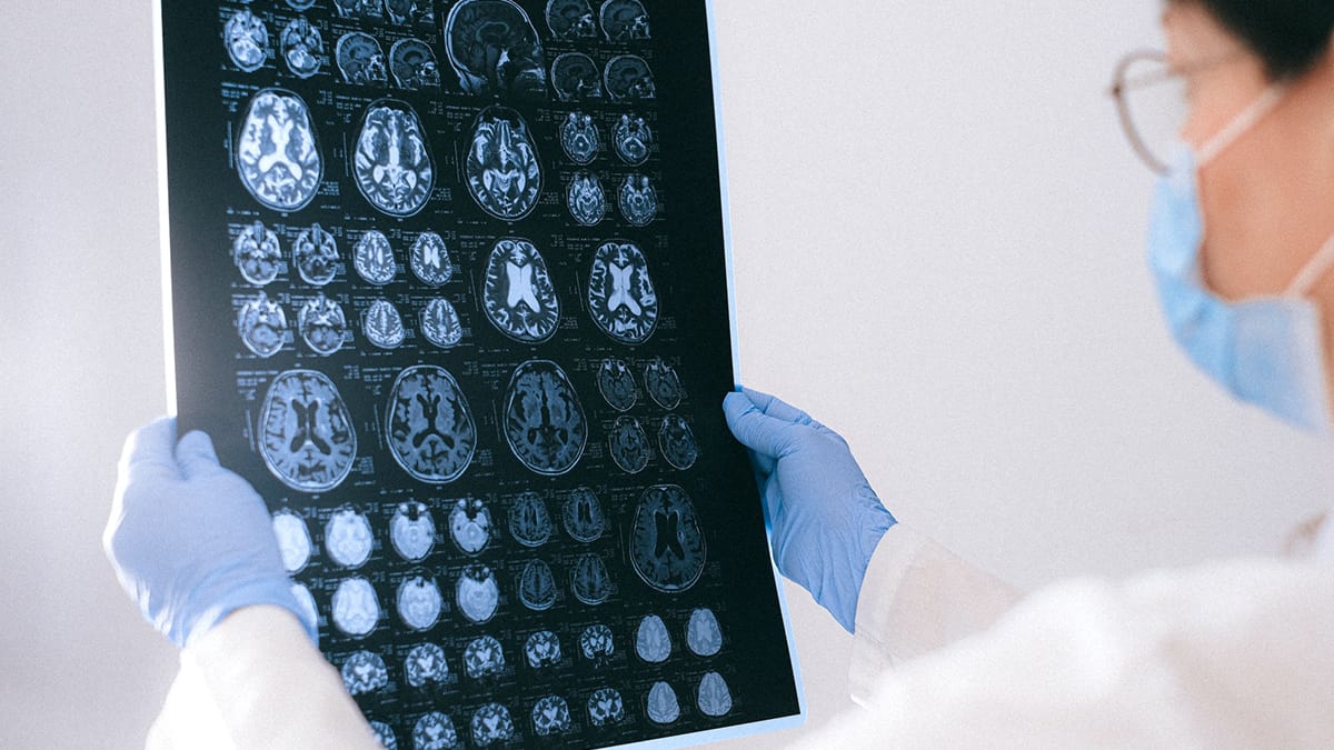 Doctor inspecting brain scans