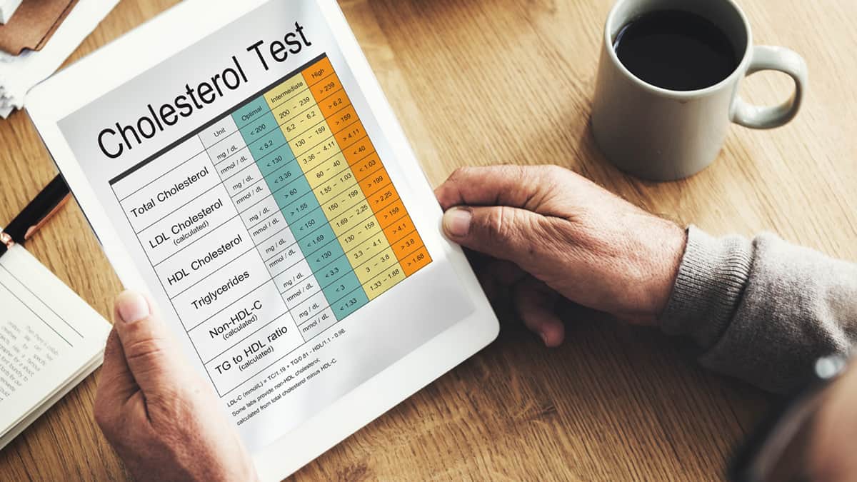 Cholesterol Test Chart